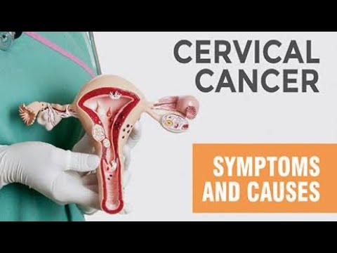 REASONS YOU SHOULD TAKE THAT CERVICAL CANCER VACCINE [Video]