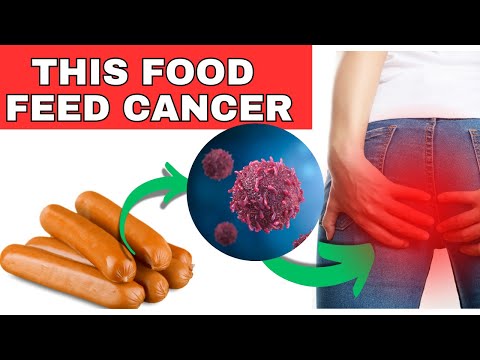 The shocking truth: 99% eat this daily without knowing it feeds cancer! [Video]