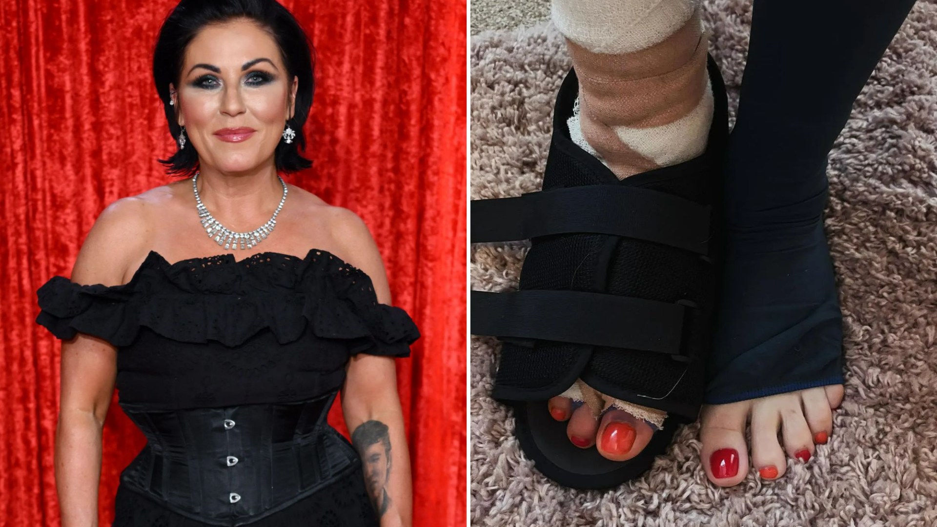 EastEnders star Jessie Wallace undergoes surgery after years of ‘excruciating pain’ [Video]