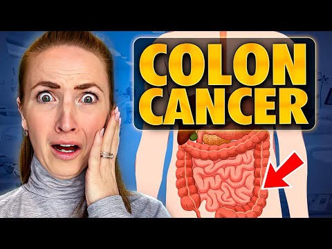 Signs of Colon Cancer (& What to Do About It) [Video]