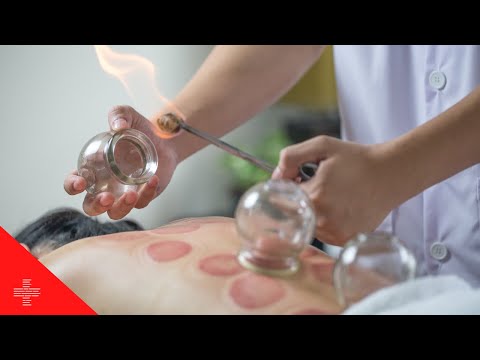 I Tried Traditional Chinese Medicine For A Week [Video]