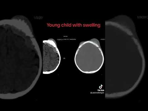 Radiology Viva exam spotter Case 2 #pediatrics  #CT Scan #viva  #exams  [Video]