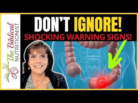 3 SHOCKING Early Warning Signs of Colon Cancer You Never Knew! [Video]
