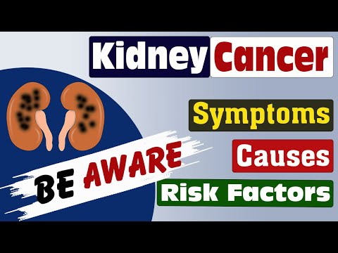 “Understanding Kidney Cancer: Symptoms | Causes | Risk factors | prevention Tips” [Video]