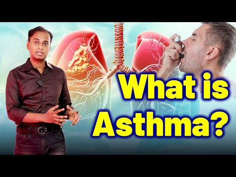 What is Asthma? – Homeopathy Treatment & Cure | Dr. Bharadwaz | Homeopathy, Medicine & Surgery [Video]