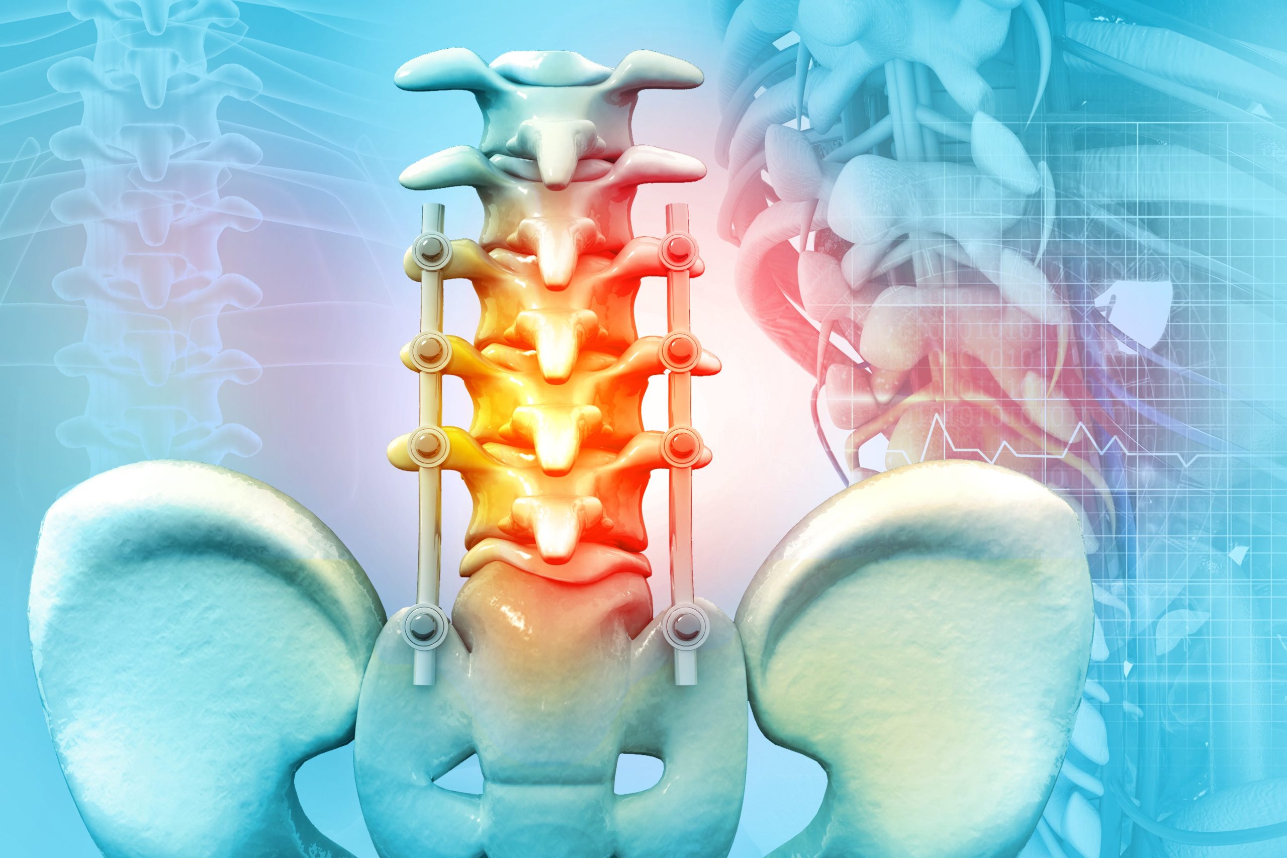 Understanding Spinal Stenosis: Symptoms & Treatment Options [Video]
