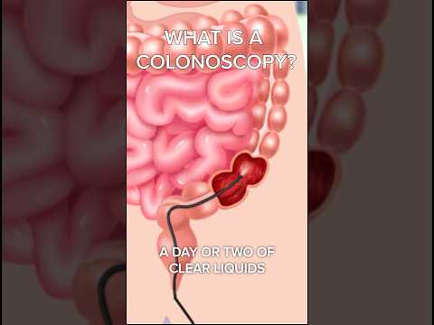 This Is What Happens During a Colonoscopy! [Video]