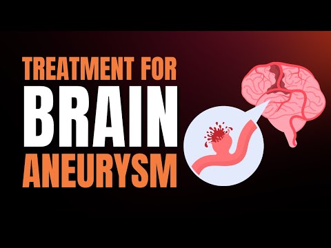 Non-surgical Vs. Surgical: Which Treatment Works Best For Brain Aneurysms? [Video]