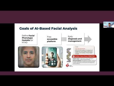 AI-Powered Facial Analysis for Early Diagnosis of Genetic Aortopathies [Video]