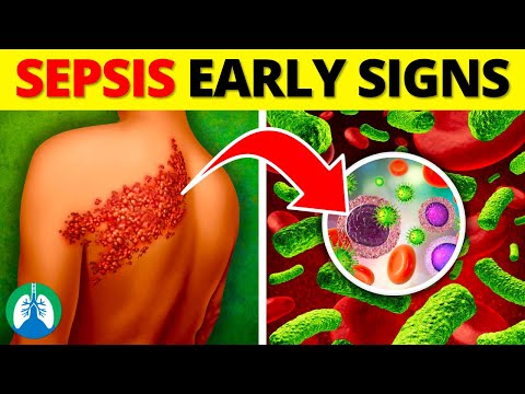 Top 10 Early Warning Signs of Sepsis | NEVER Ignore THIS [Video]
