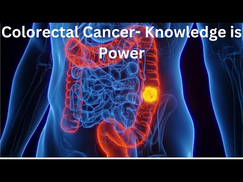 Understanding Colorectal Cancer: Early Detection, Prevention, Symptoms, and Treatments [Video]