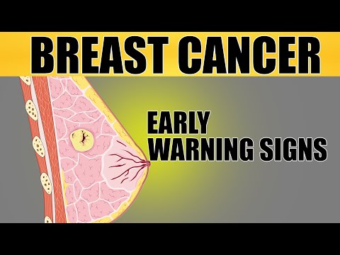 5 warning signs of breast cancer you should not ignore.#cancer [Video]