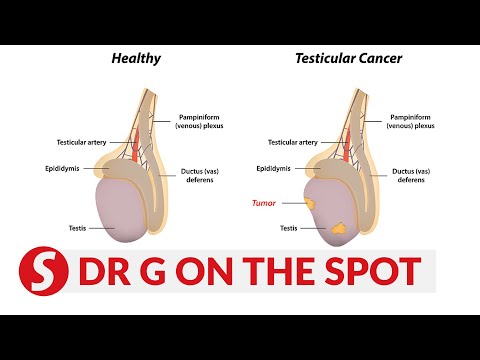 EP229: Testicle cancer, treatment and teens | PUTTING DR G ON THE SPOT [Video]