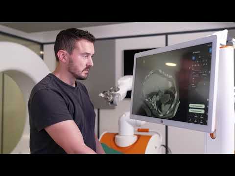 Cancer treatment with the Epione medical robot [Video]