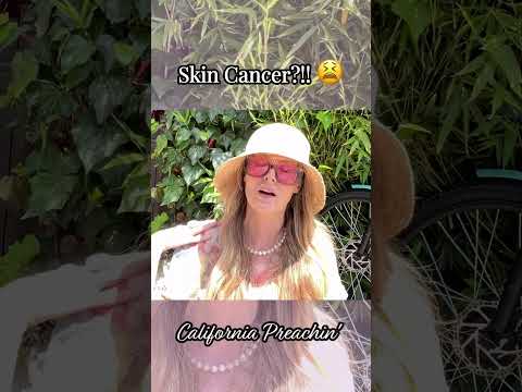 Skin Cancer?!! 😫 [Video]