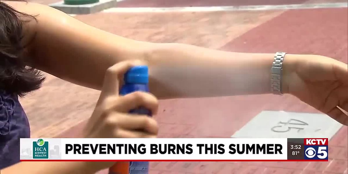 HCA Midwest: Preventing Burns This Summer [Video]