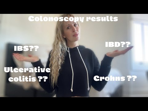 Colonoscopy result!!! | ft ibs bloat videos 😫 |