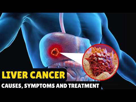 Liver Cancer – Causes, Signs and Symptoms, Diagnosis & Treatment [Video]