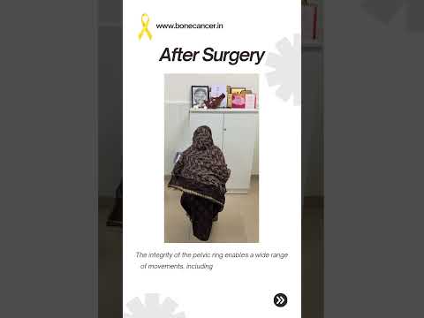 Surgery for Pelvic Bone Sarcoma by Dr Srimanth B S | [Video]